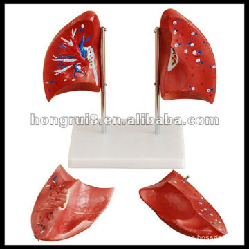 ISO 2012 Human Lung Anatomy Model HR-321